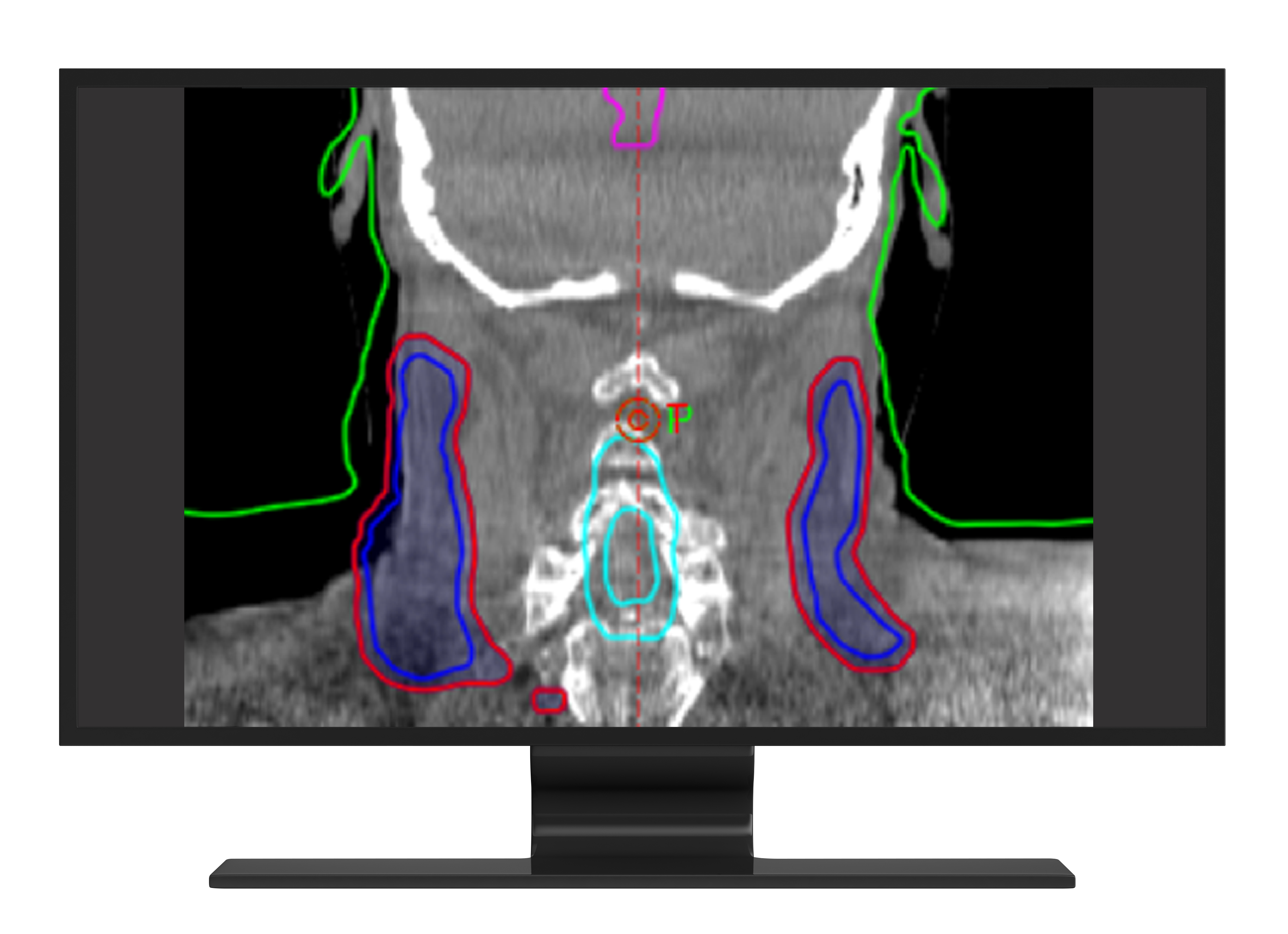 Monitor head neck 061124 b