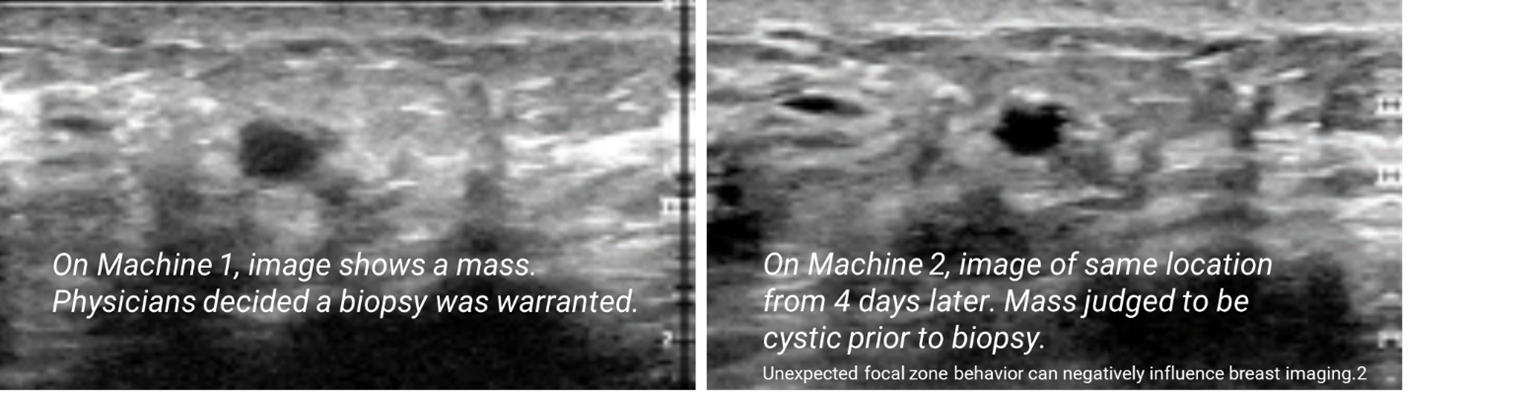 Ultrasound Focal Settings